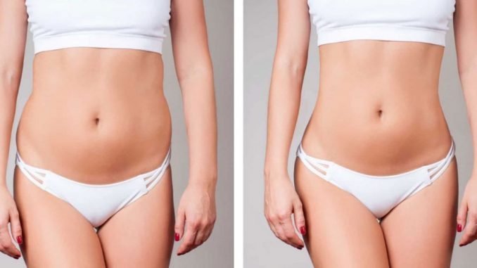 LIPOSUCTION WITH LIPOMATIC